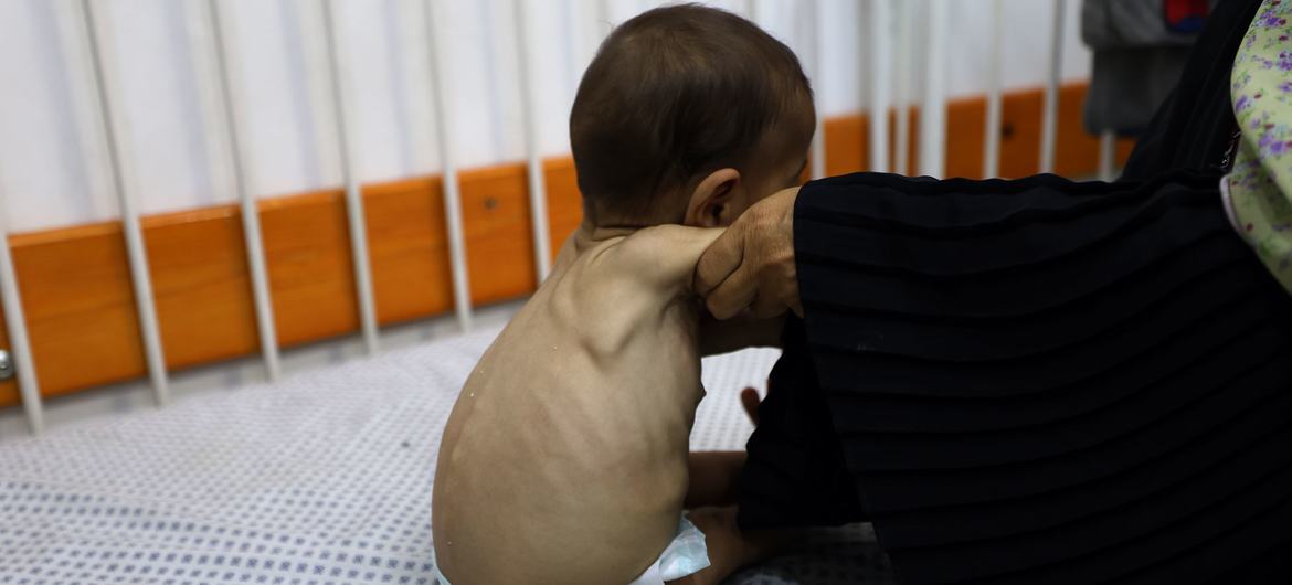 ‘No one should ever be forced to risk their life to find food,’ says UN humanitarian agency — Global Issues